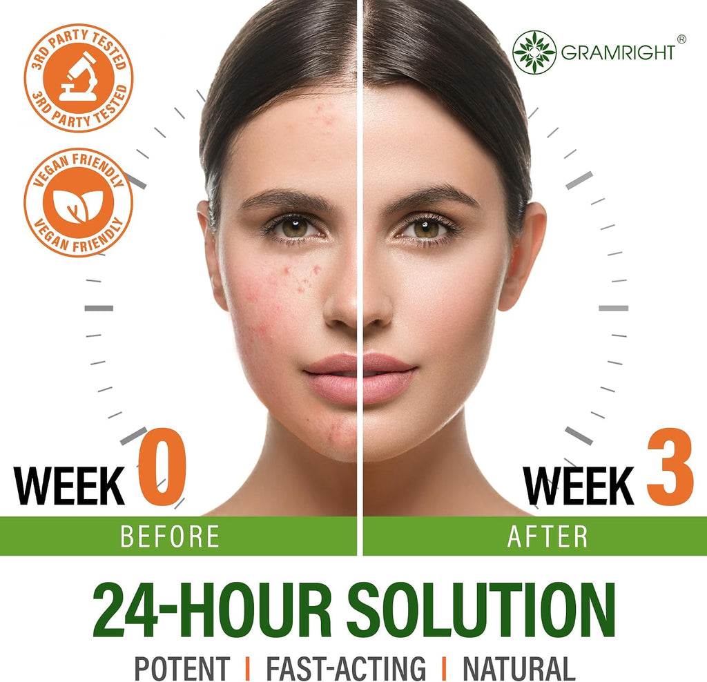 GRAMRIGHT-Acne Face Cream - Acne Spot Treatment for Face & Acne Dots