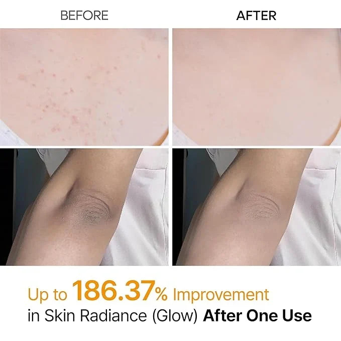 Buy 1 Get 1 Free Dr. Melaxin Kojic Acid Turmeric Spray